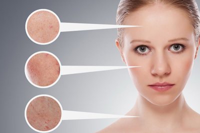 生理期皮肤差怎么办 四大保养步骤改善肌肤