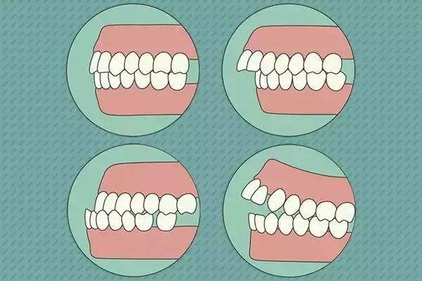 牙齿美白最好的方法是什么