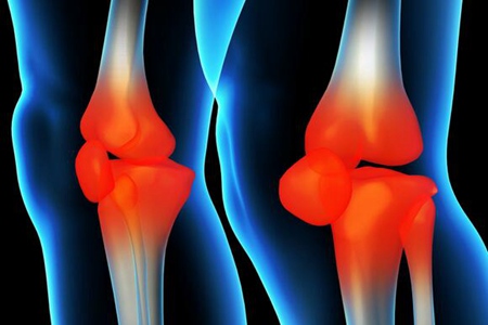 膝盖关节炎怎么治疗？膝盖关节炎怎么治疗