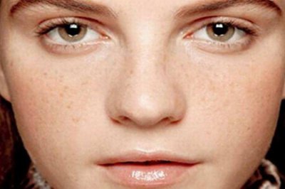 女人脸上长斑的原因是什么？ 女人脸上长斑是什么原因引起