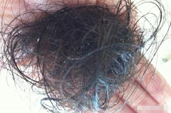 频繁洗头发会掉发吗？