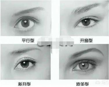 双眼皮的类型有哪几种 双眼皮有哪些类型(种类)