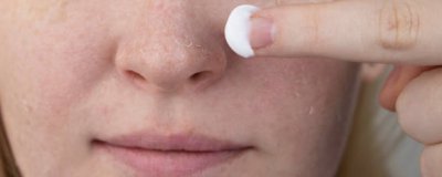脸卡粉浮粉是什么原因？ 脸上卡粉浮粉是什么原因