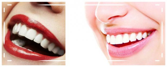 用什么能让牙齿快速变白？