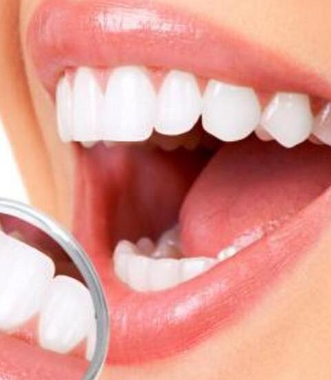 冷光美白牙齿可以保持多久？冷光美白牙齿后如何护理？