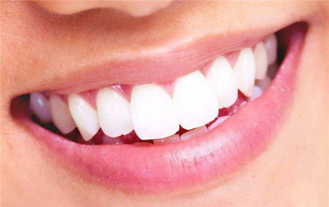 牙黄变白最实用的方法分享