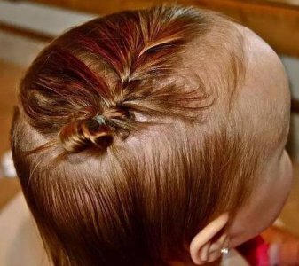 2一3岁女宝宝发型扎法有哪些 2一3岁女宝宝头发稀少怎么办