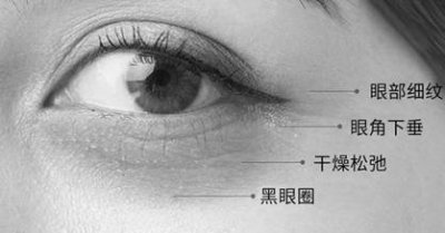 冬天正确的眼部护理方法 眼部护理8大误区