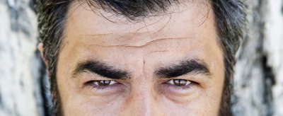 如何消除眼角皱纹 眼部皱纹产生的原因