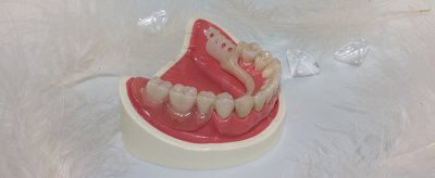 牙黄怎么办 造成牙黄的原因