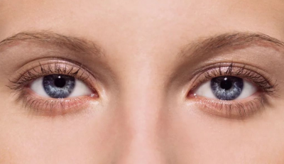眼部下垂怎么修复 怎么保护眼部皮肤