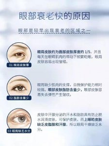 眼周皱纹如何改善 眼周皱纹的改善方法